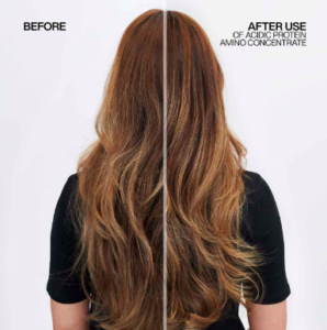 before and after acidic bonding concentrate