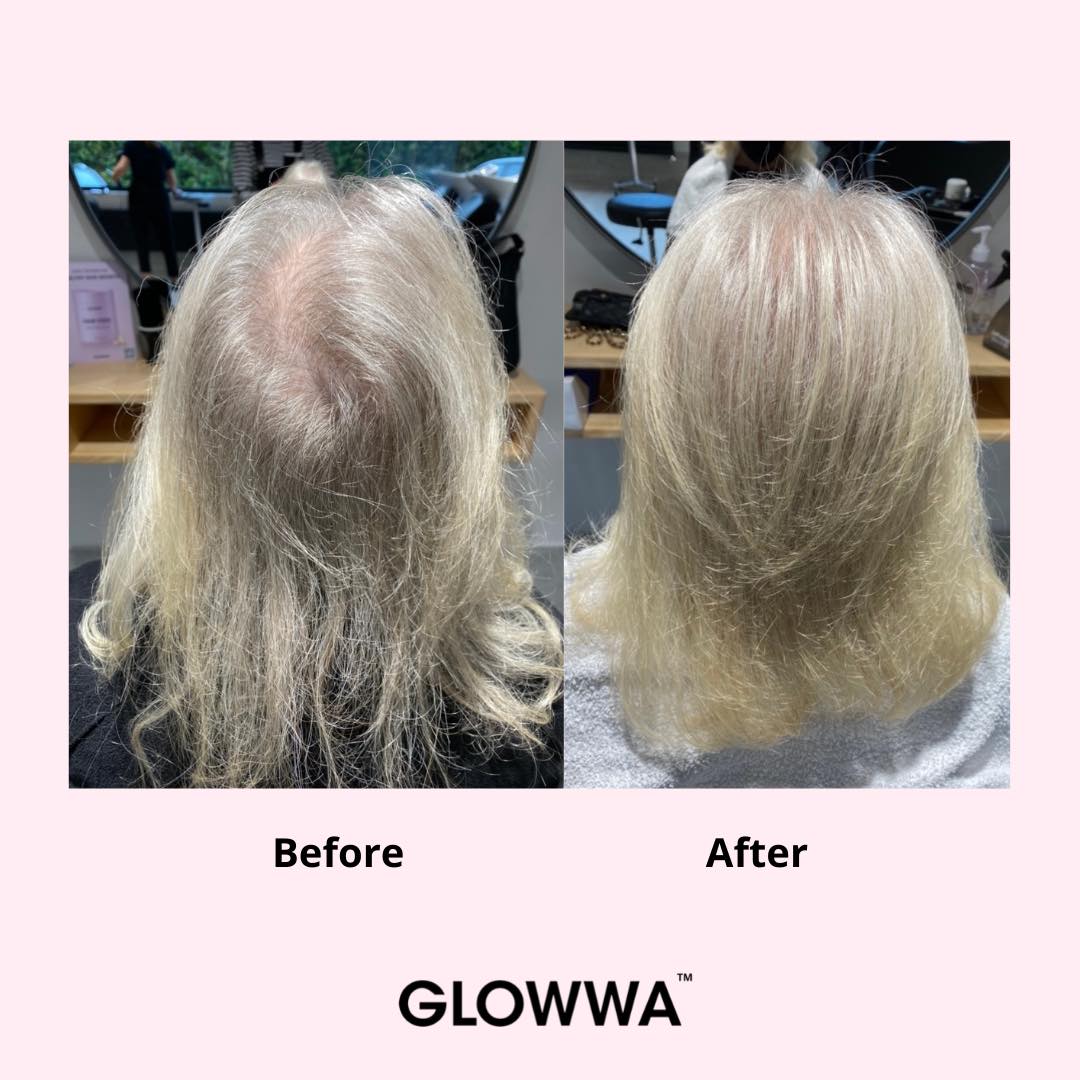 Before-and-After-GLOWWA-1