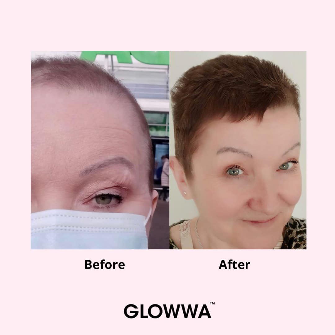 Before-and-After-GLOWWA-4