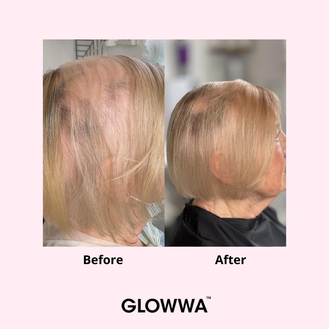 Before-and-After-GLOWWA-5